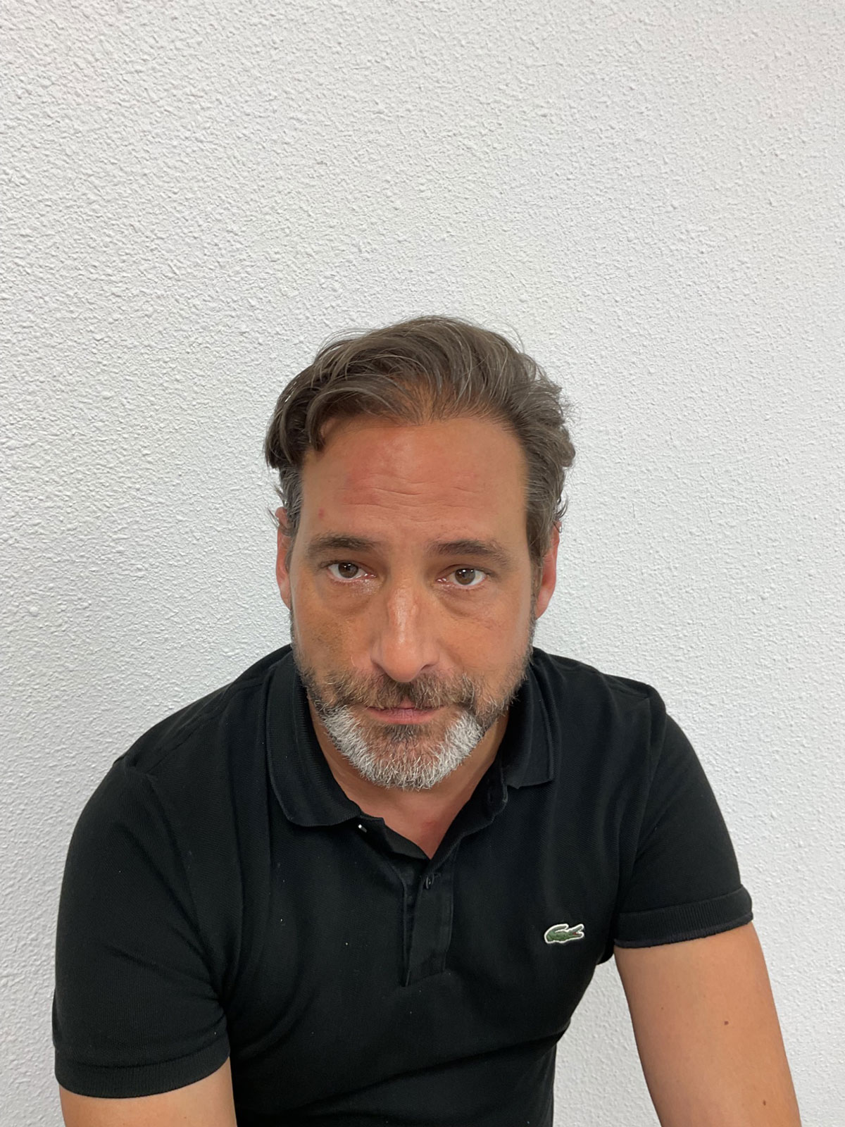 After Omorfy